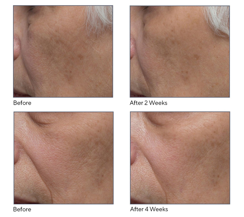 ELEMIS Dynamic Resurfacing Facial Pads & Super-C Serum — View 6