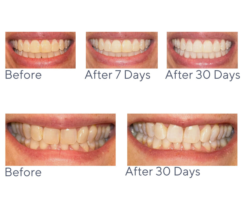 Smileactives Super-Size Pro Teeth Whitening 7.6oz Gel — View 3
