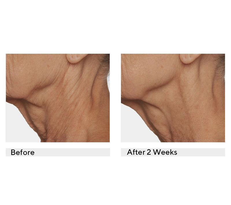 Lancer Gravity Defying Anti-Aging Moisturizer — View 5