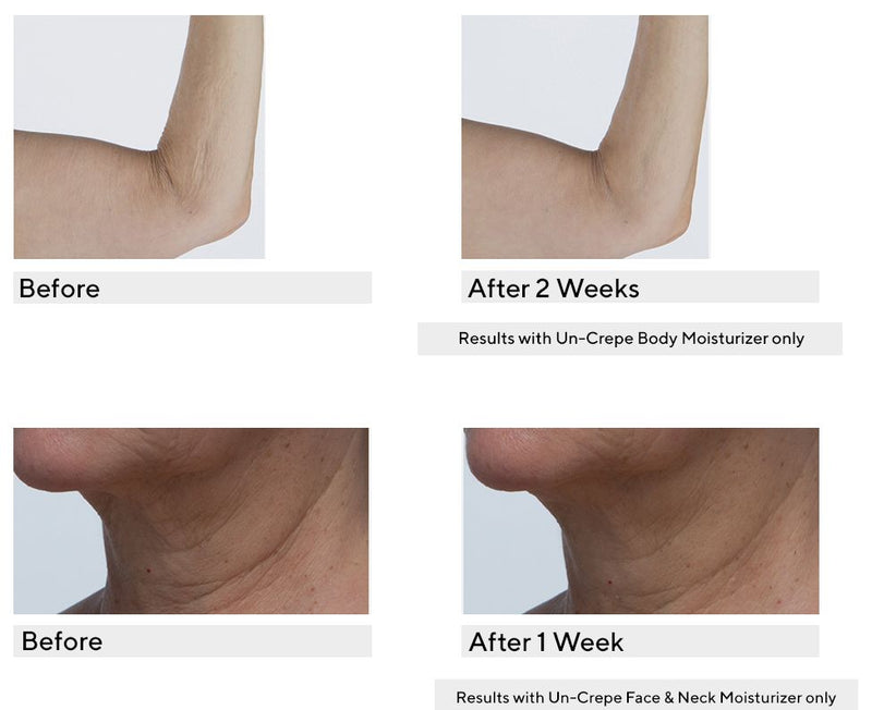 Peter Thomas Roth Un-Crepe Face & Body Moisturizer Set — View 2