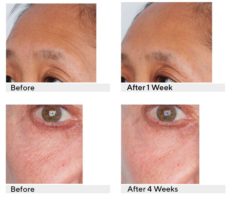 Perricone MD Retinol Recovery Overnight Moisturizer — View 8