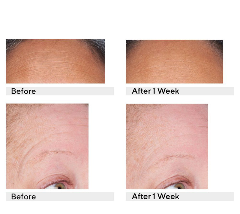 Perricone MD Retinol Recovery Overnight Moisturizer — View 7