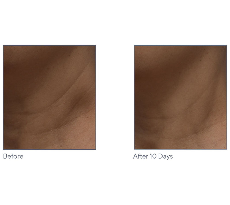 Algenist GENIUS Liquid Collagen Home & Away Set — View 5