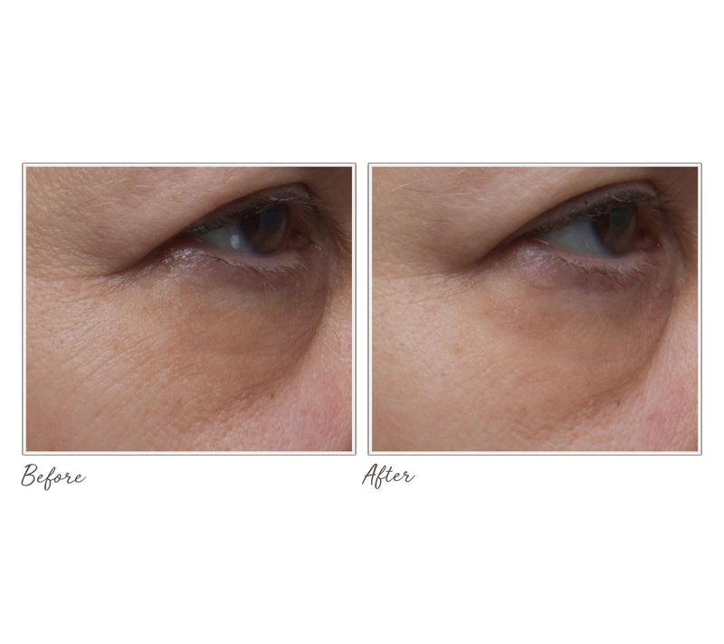 Algenist Microalgae Retinol Serum & Sleeping Collagen Cream — View 5