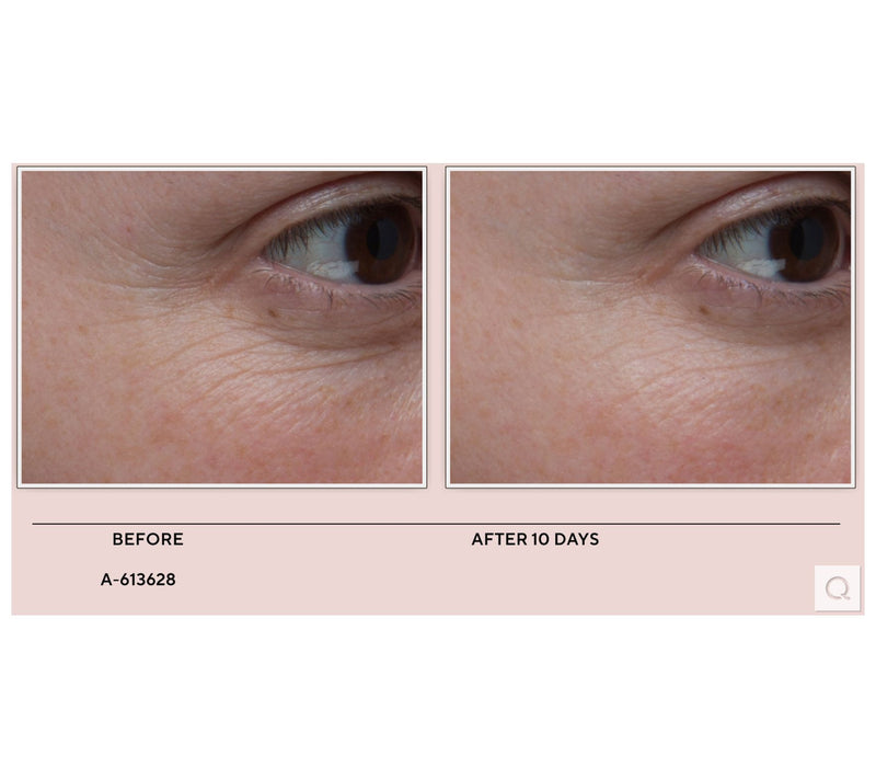Algenist Microalgae Retinol Serum & Sleeping Collagen Cream — View 3