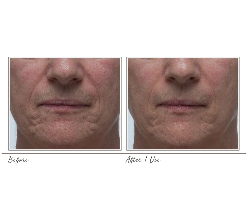 Dr. Denese Collagen Firming Peel Off Mask, 4 oz — View 5