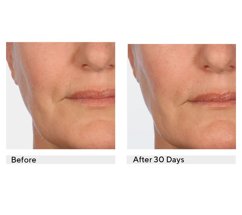 SERIOUS SKINCARE C3 C-Cream SPF Duo — View 4