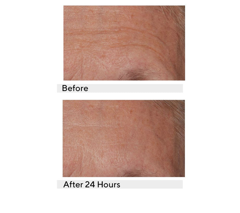 Lancer Gravity Age Defying Moisturizer Auto-Delivery — View 6