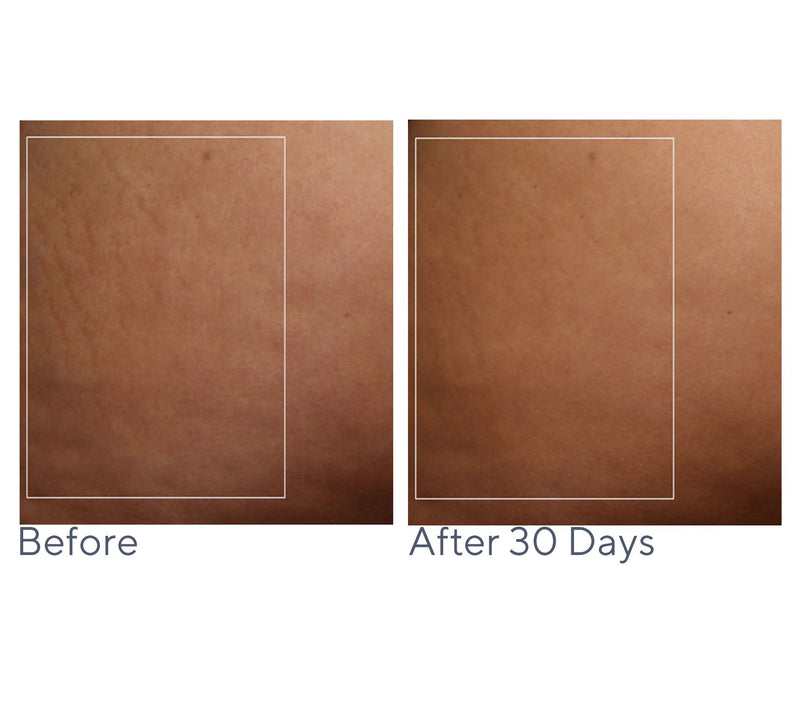 NuBODY by NuFACE Skin Toning Device & Gel Auto-Delivery — View 4