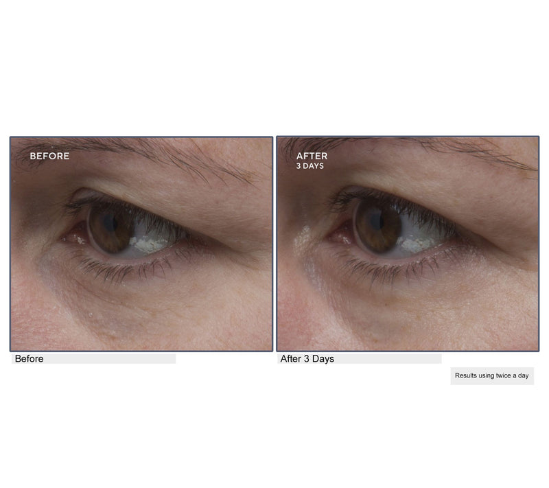 Lancer Gravity Defying Eye Cream  Complex — View 7
