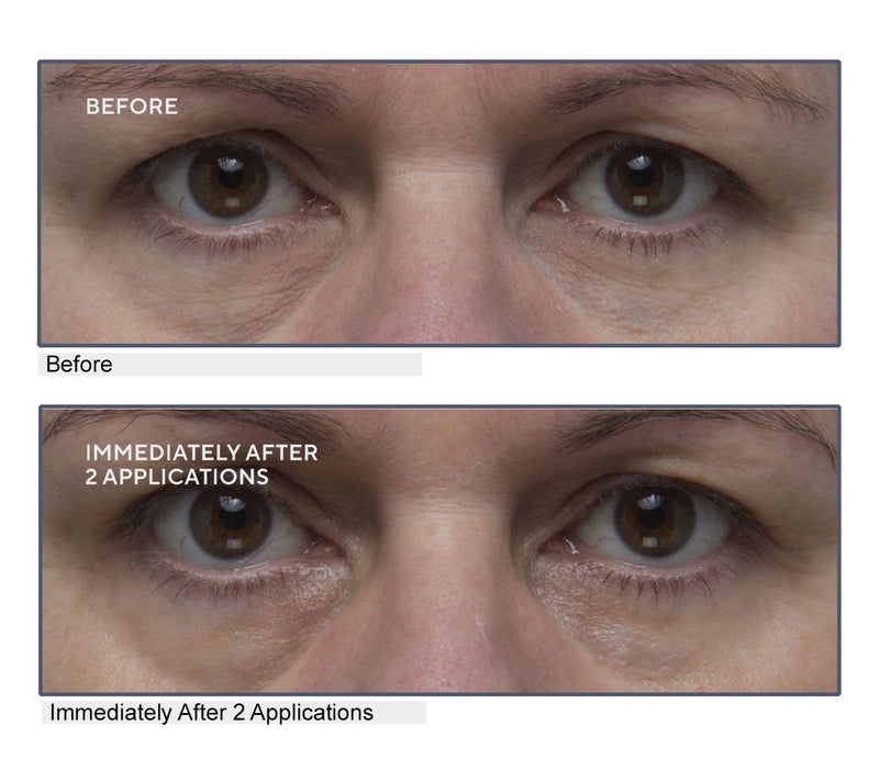 Lancer Gravity Defying Eye Cream  Complex — View 8