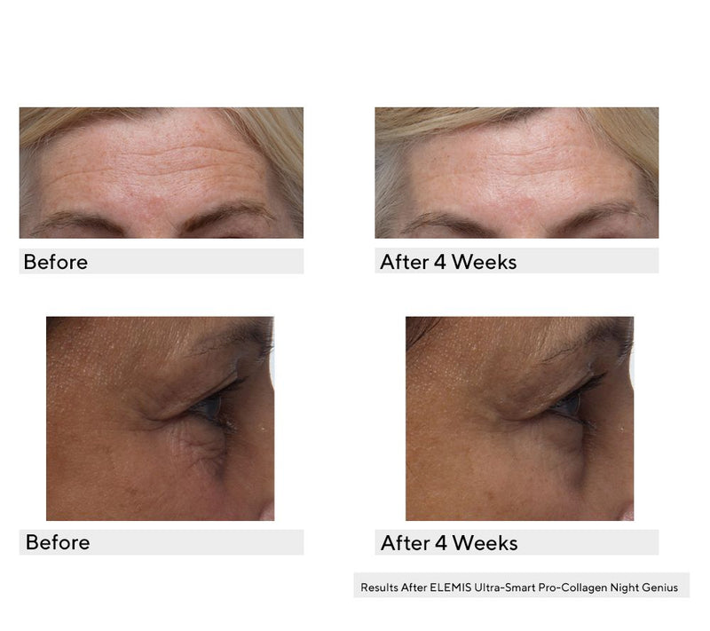 ELEMIS Ultra-Smart Pro-Collagen Day & Night Cream AM/PM Set — View 5