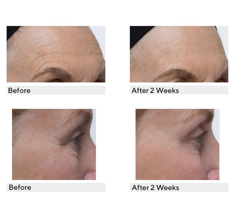 ELEMIS Ultra-Smart Pro-Collagen Day & Night Cream AM/PM Set — View 6