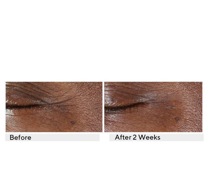 KAPLAN MD Diamond Contour Ultimate Eye Serum Duo Auto-Delivery — View 8