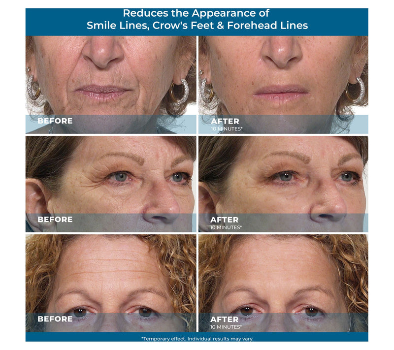 Plexaderm Rapid Reduction Serum Duo — View 6