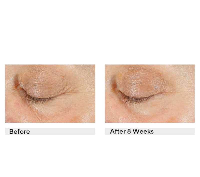 StriVectin Advanced Retinol Multi-Correct Eye Cream Duo — View 7