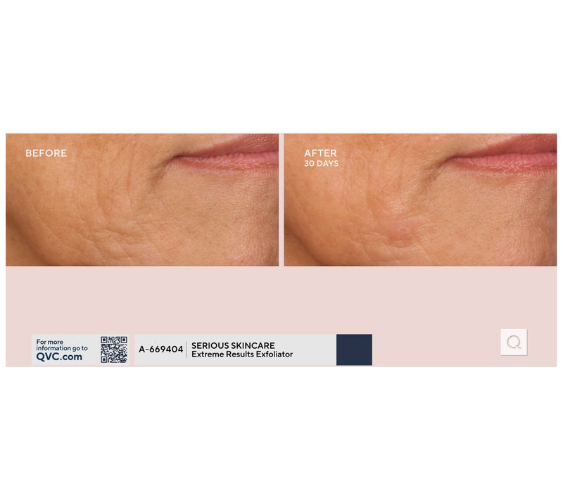 SERIOUS SKINCARE C-Extreme Results Exfoliator — View 7