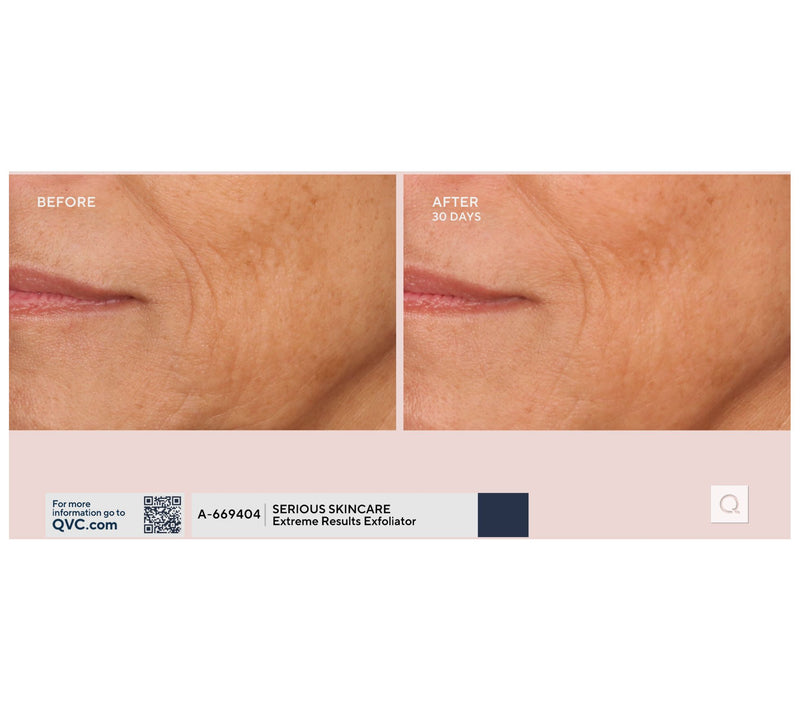 SERIOUS SKINCARE C-Extreme Results Exfoliator — View 6