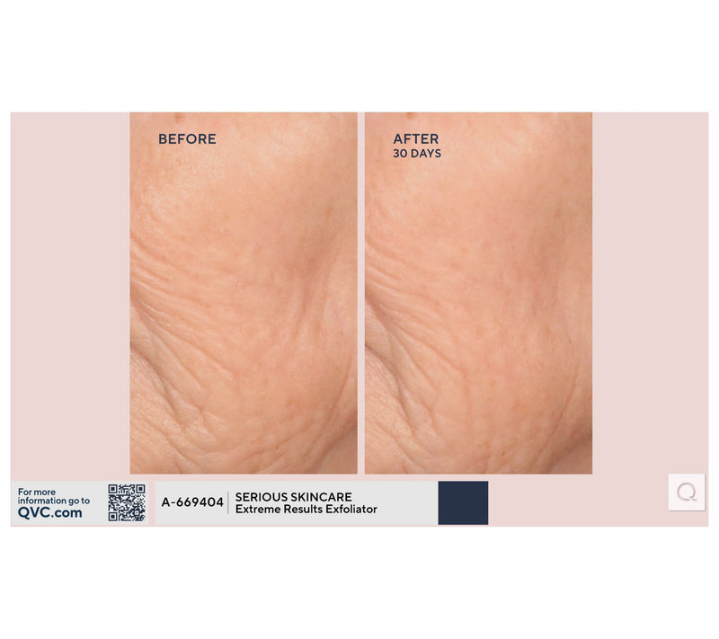 SERIOUS SKINCARE C-Extreme Results Exfoliator — View 8