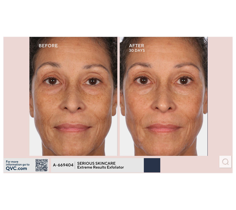 SERIOUS SKINCARE C-Extreme Results Exfoliator — View 4