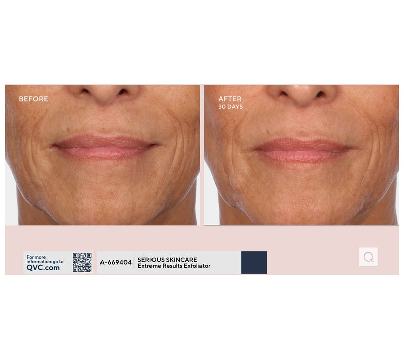 SERIOUS SKINCARE C-Extreme Results Exfoliator — View 5