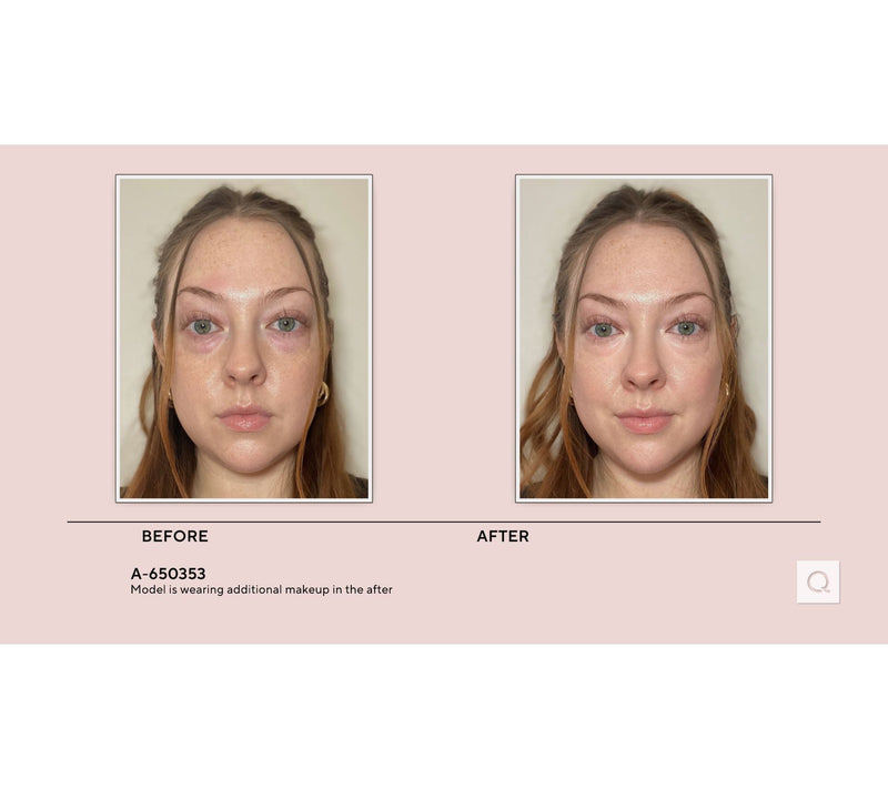 Doll 10 T.C.E Luminous Undereye Corrector — View 5