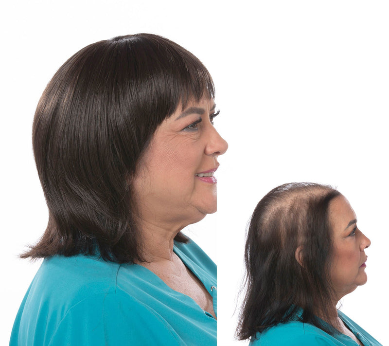 Toni Brattin Complete Coverage Total Topper Hairpiece — View 32