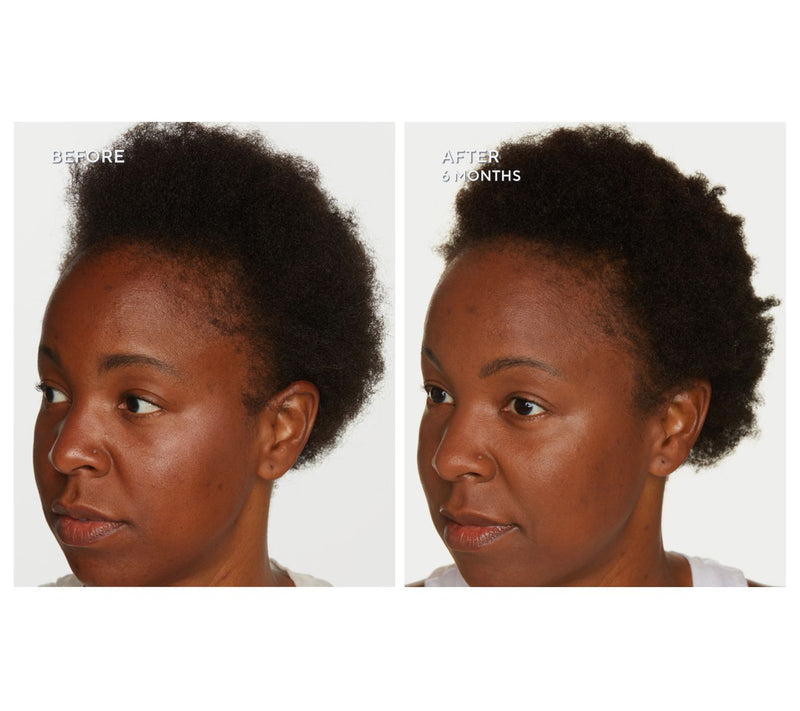WEN by Chaz Dean 8oz Botanical Scalp & Hair Tonic Duo — View 4