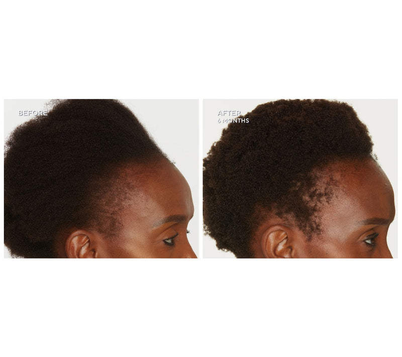 WEN by Chaz Dean 8oz Botanical Scalp & Hair Tonic Duo — View 8