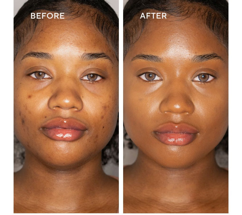 Doll 10 Reishi Serum Concealer with Brush — View 26