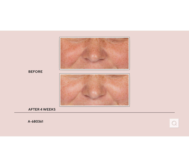 Stripes The Power Move Hydrating & Plumping Facial Serum — View 7