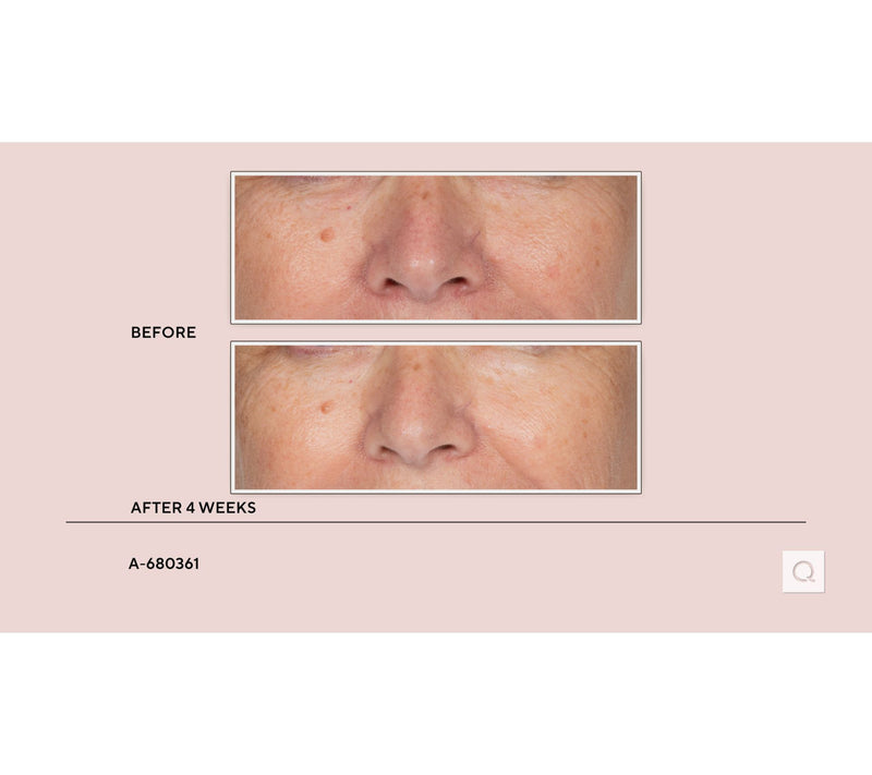 Stripes The Power Move Hydrating & Plumping Facial Serum — View 6
