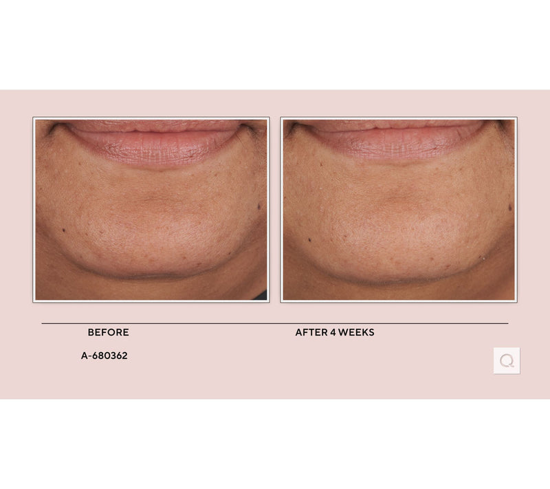 Stripes Dew As I Do Brightening & Hydrating Cream — View 5