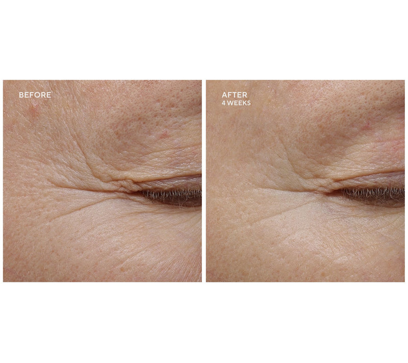Whish Revitalizing Eye Cream 0.5oz Duo w/ Bakuchiol — View 6
