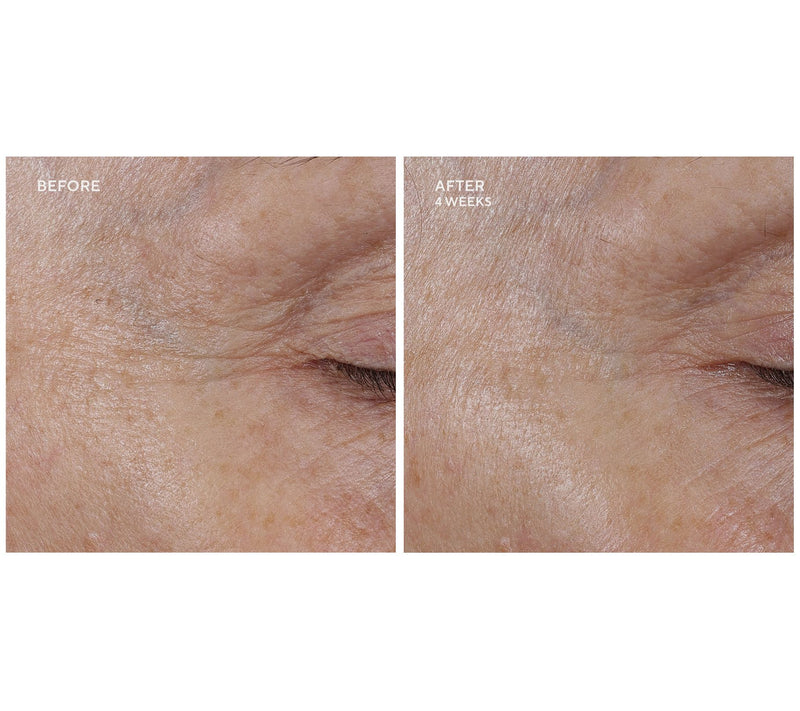 Whish Revitalizing Eye Cream 0.5oz Duo w/ Bakuchiol — View 7