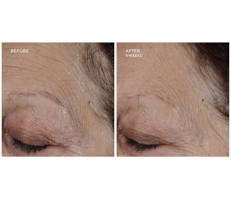 Whish Revitalizing Eye Cream 0.5oz Duo w/ Bakuchiol — View 8