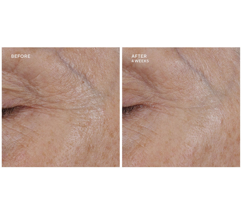 Whish Revitalizing Eye Cream 0.5oz Duo w/ Bakuchiol — View 4