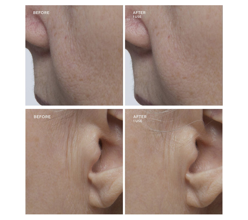 Gatineau Age Benefit Refining Multi-Acid Peel — View 8