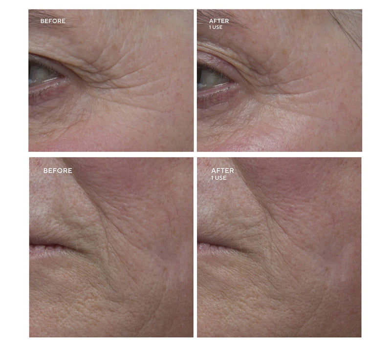 Gatineau Age Benefit Refining Multi-Acid Peel — View 7