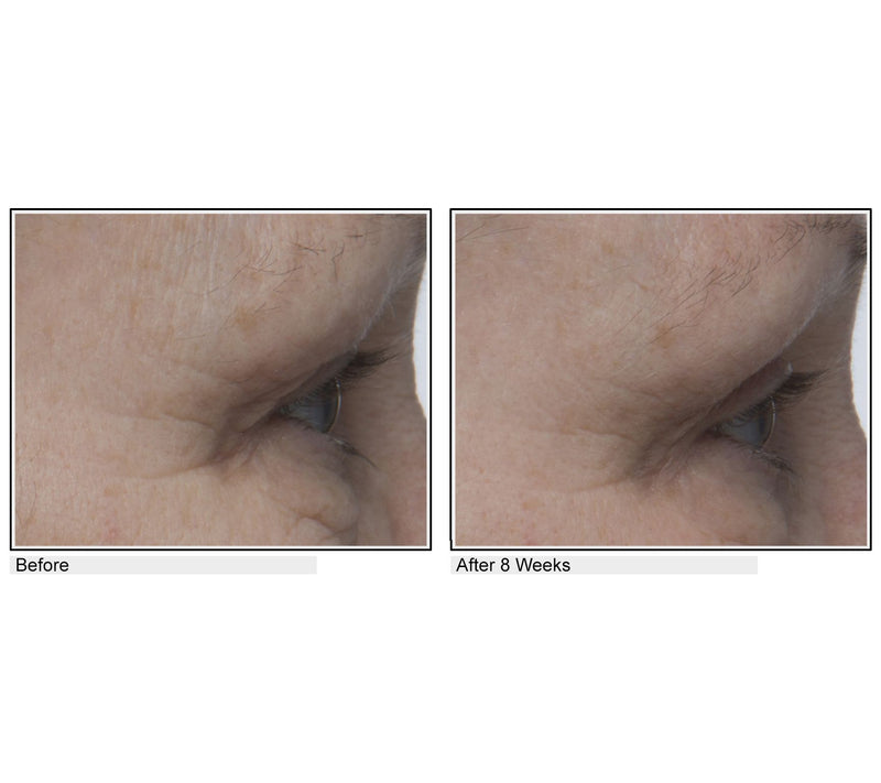 Body Firm Essentials Lift & Smooth Eyelid Treatment — View 3