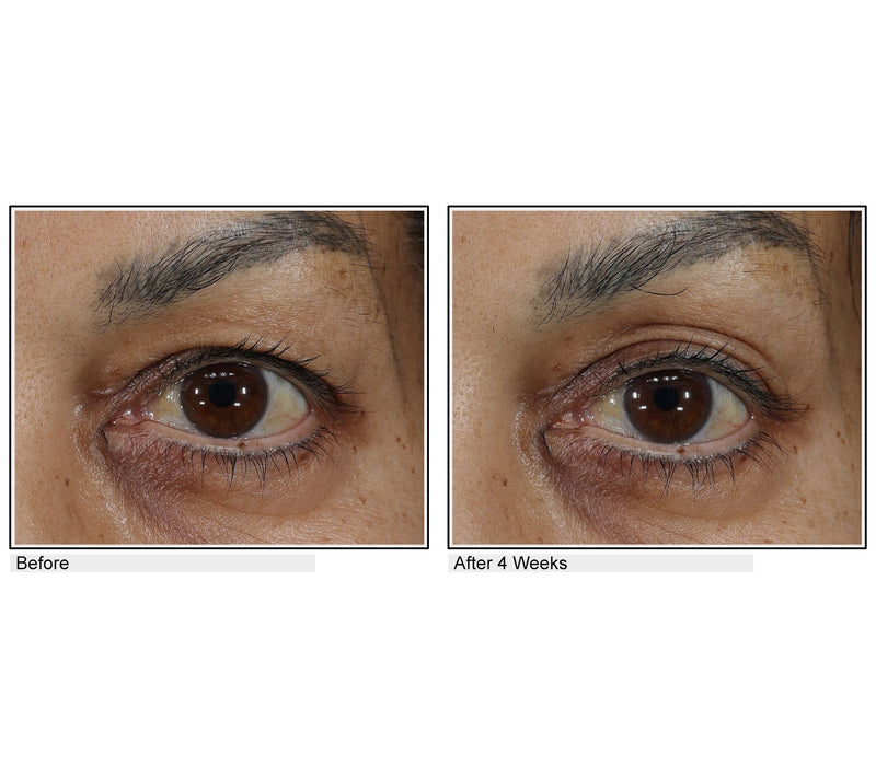 Body Firm Essentials Lift & Smooth Eyelid Treatment — View 6