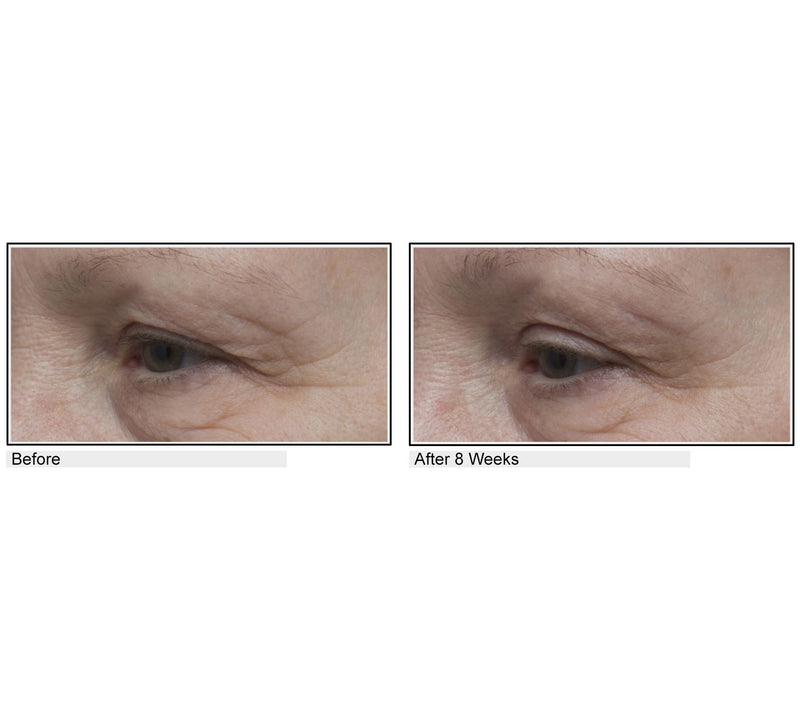 Body Firm Essentials Lift & Smooth Eyelid Treatment — View 2