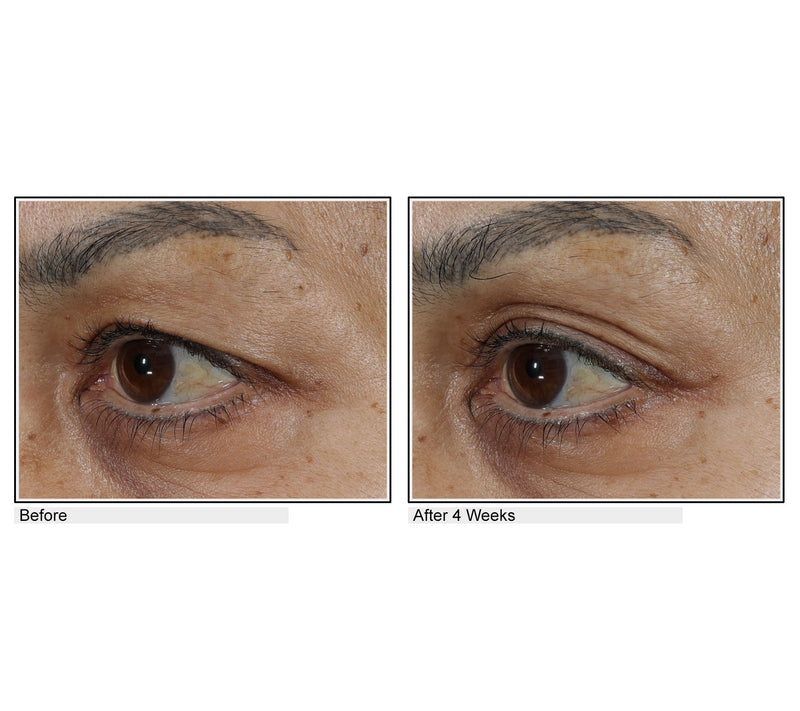 Body Firm Essentials Lift & Smooth Eyelid Treatment — View 7