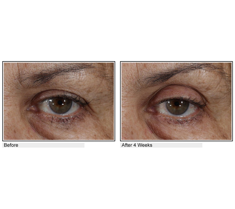 Body Firm Essentials Lift & Smooth Eyelid Treatment — View 5
