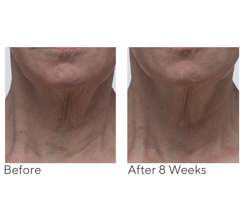 Crepe Erase Neck Repair Treatment Home & AWay 2pc Set — View 6