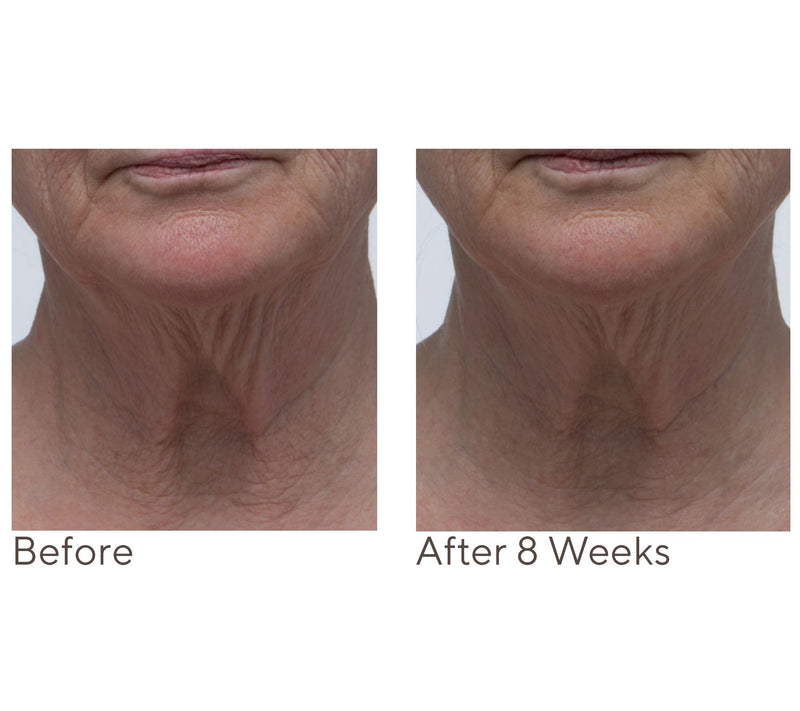 Crepe Erase Neck Repair Treatment Home & AWay 2pc Set — View 4