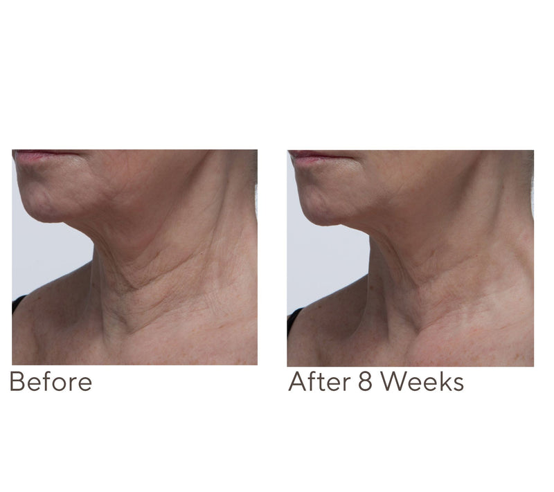 Crepe Erase Neck Repair Treatment Home & AWay 2pc Set — View 7