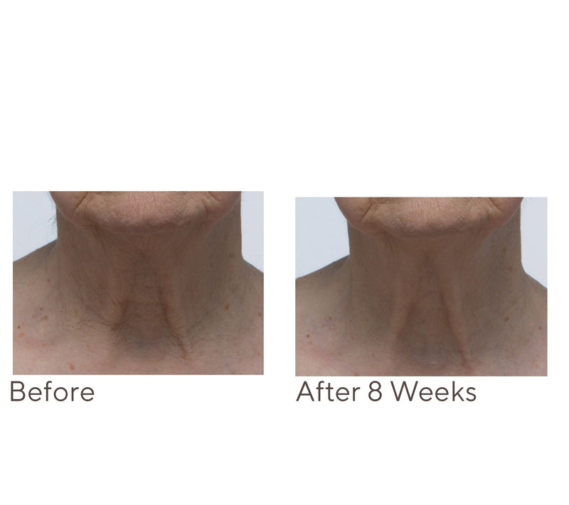 Crepe Erase Neck Repair Treatment Home & AWay 2pc Set — View 8