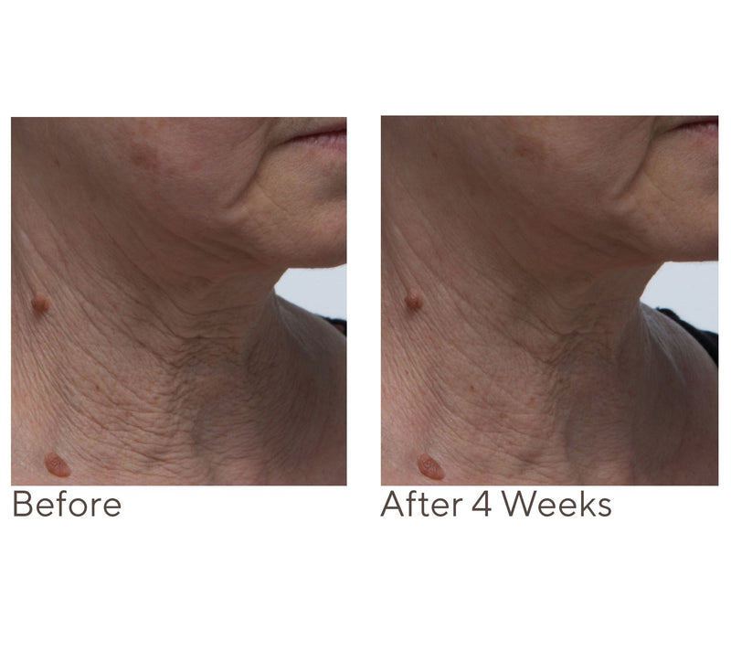 Crepe Erase Neck Repair Treatment Home & AWay 2pc Set — View 3