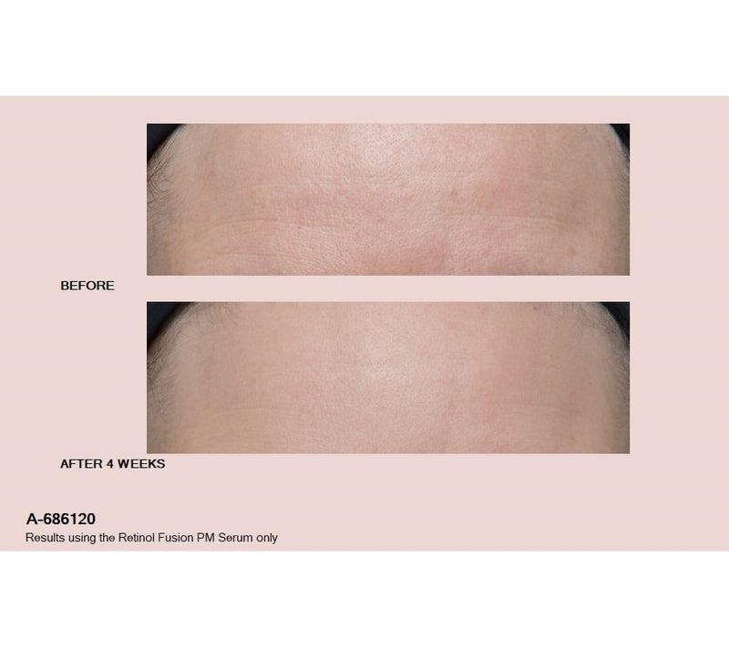 Peter Thomas Roth Mega-Size 6.7oz & 2oz Retinol Fusion PM Serum Set — View 3